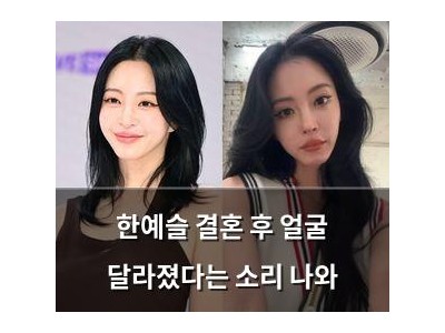 한예슬 결혼 후 얼굴 달라졌다는 소리 나와
